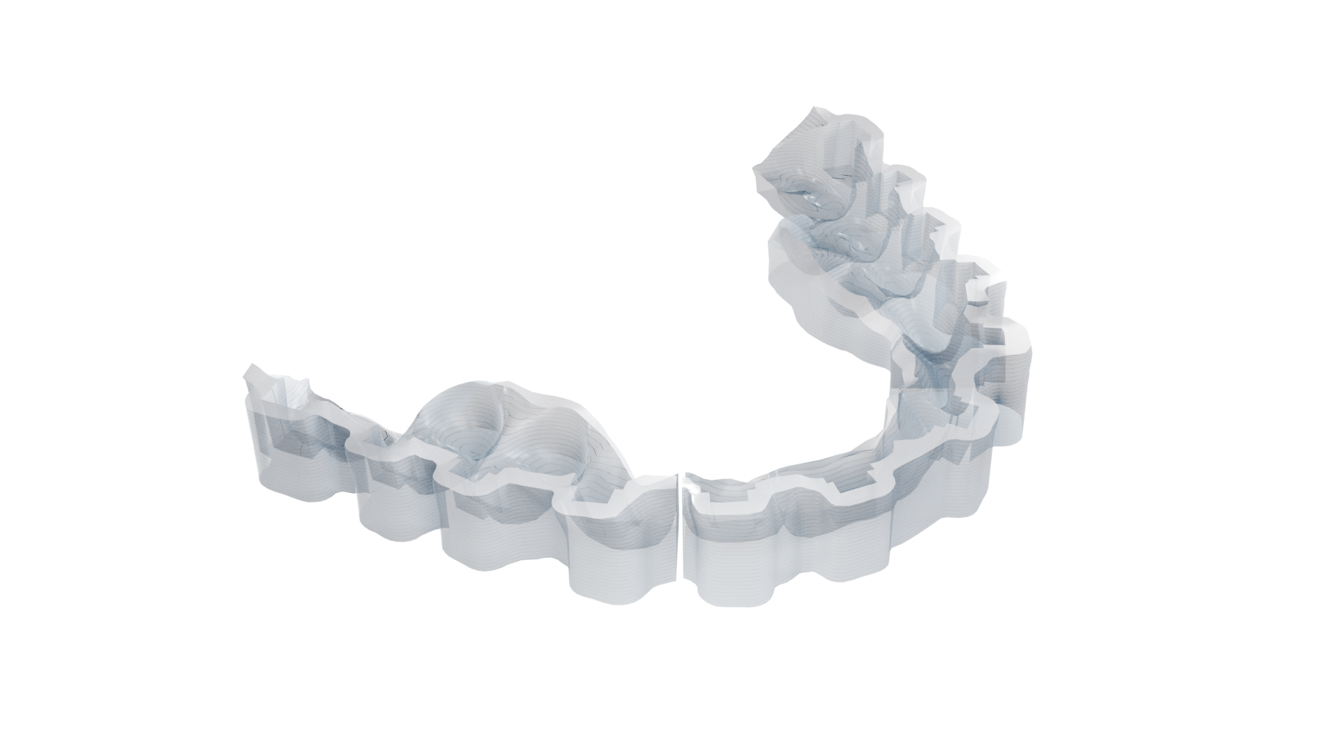 DIBS AI bonding trays with brackets inserted